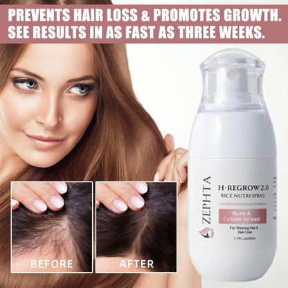 Advanced Hair Growth Spray with Rice Water, Biotin & Caffeine – Fast Thickening Treatment for Thinning Hair